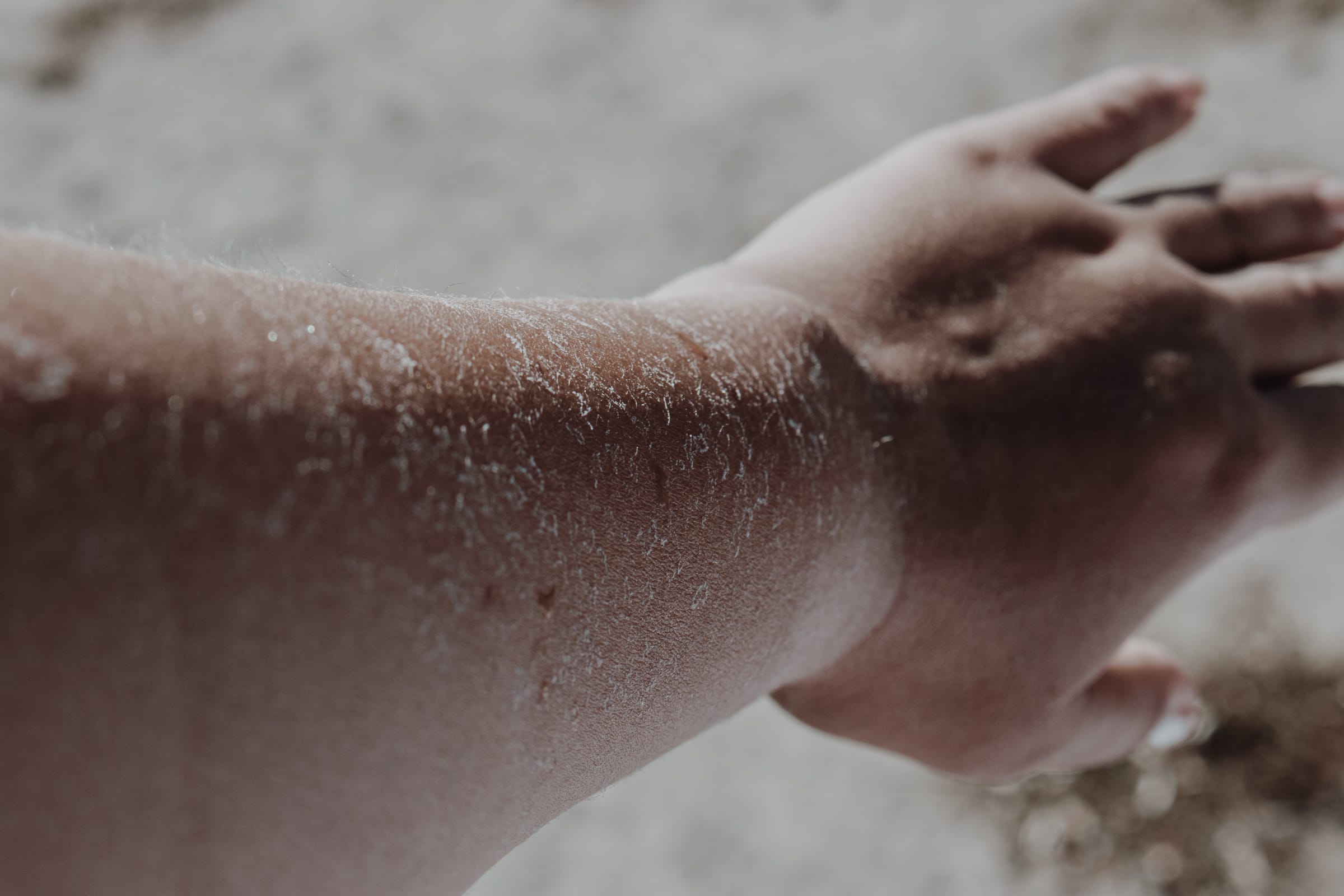 Ocna Sibiului Salzseen Hautpflege Wellness